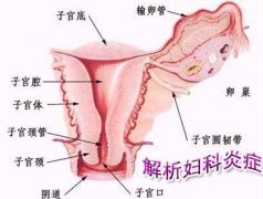 治疗阴道炎哪家医院好