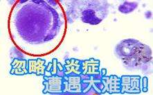 治疗外阴炎哪家医院好